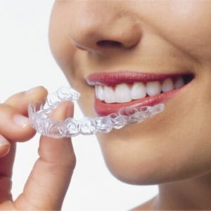 dentistry for you services invisalign background image